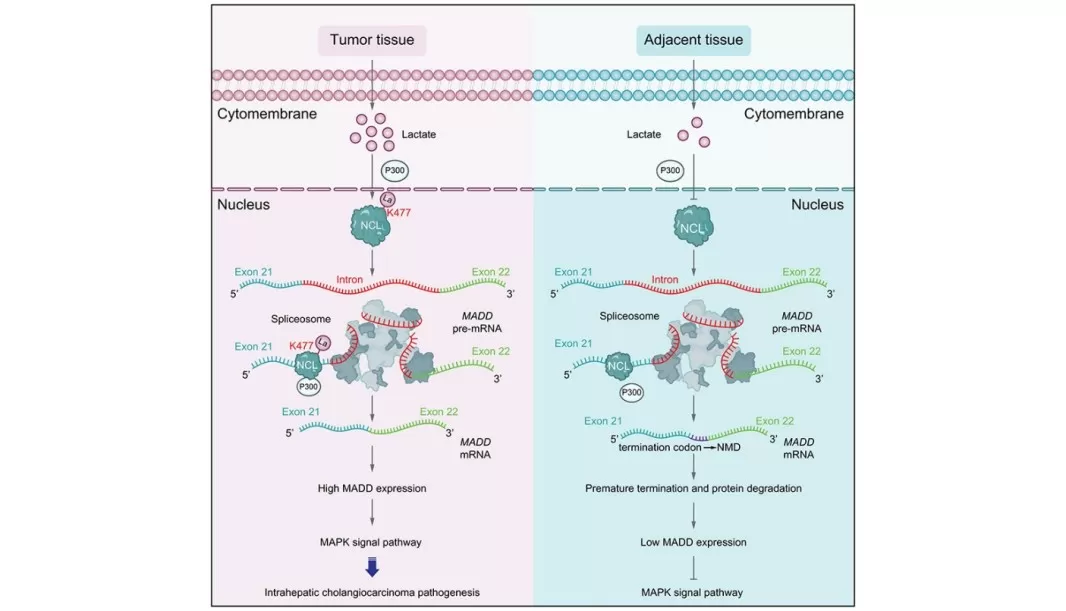 Glycolysis-Driven Nucleolin Lactylation Promotes Intrahepatic Cholangiocarcinoma Progression via MADD-Dependent ERK Activation